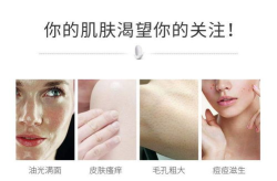 网红螨虫皂,深层清洁，告别肌肤问题